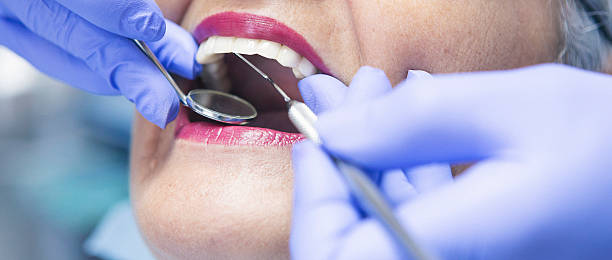 Best Knocked-Out Tooth (Avulsed Tooth) Treatment in Pquemine, LA